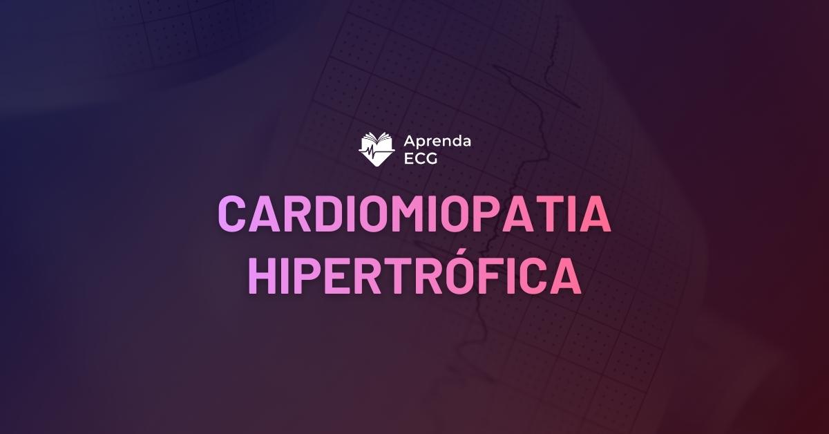 Cardiomiopatia Hipertrófica