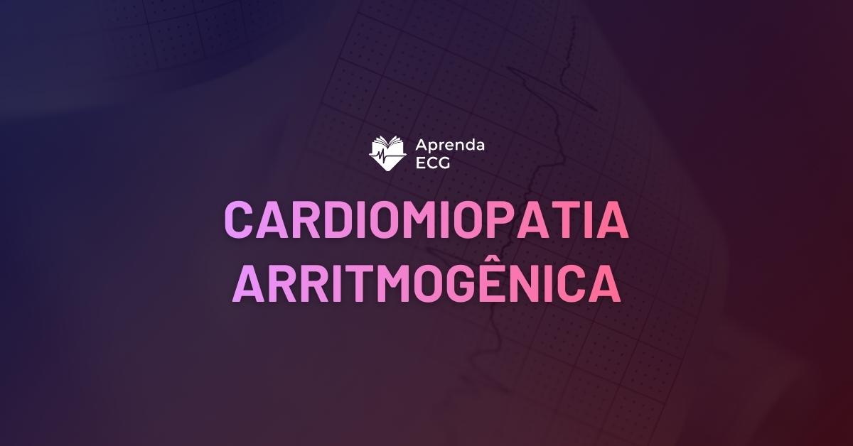 Cardiomiopatia Arritmogênica do Ventrículo Direito