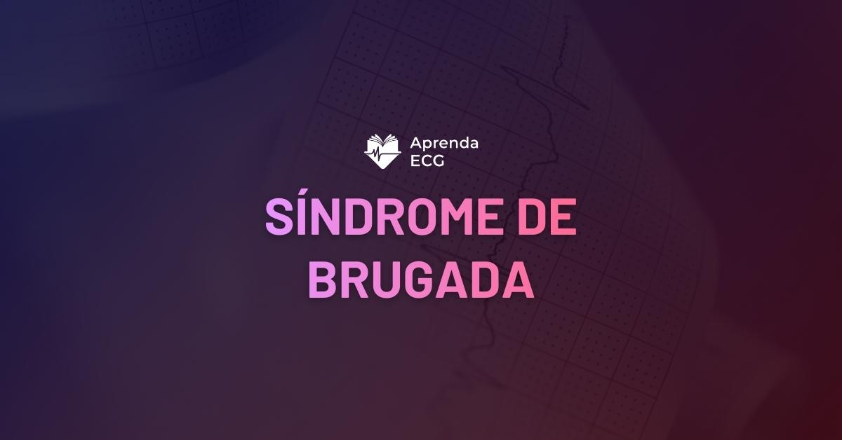 Síndrome de Brugada