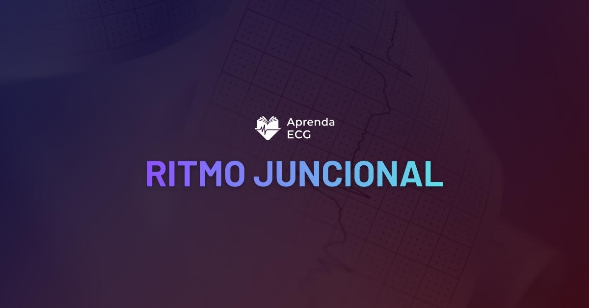 Ritmo Juncional