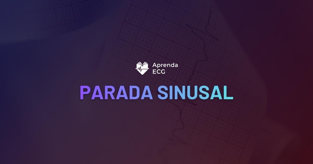 Parada Sinusal