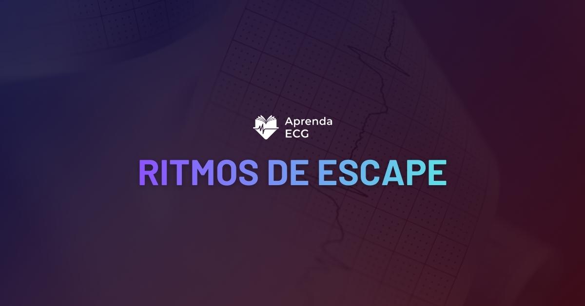 Ritmos de Escape