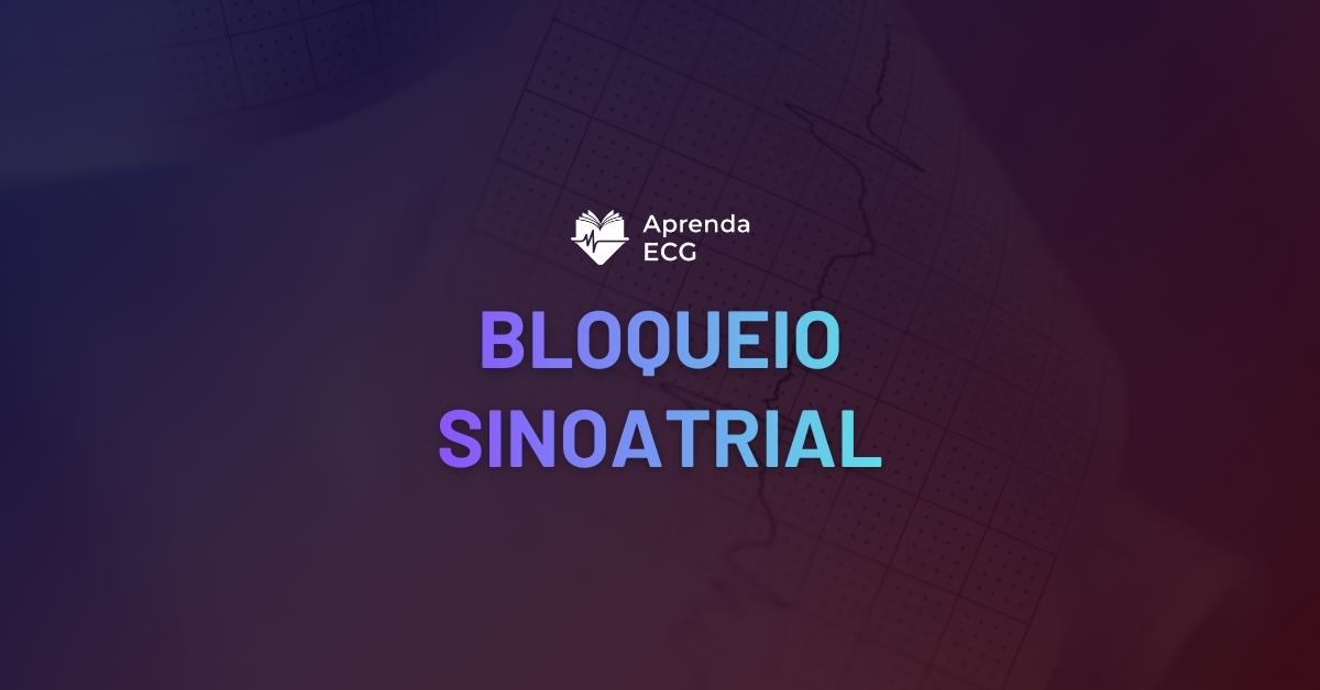 Bloqueio Sinoatrial