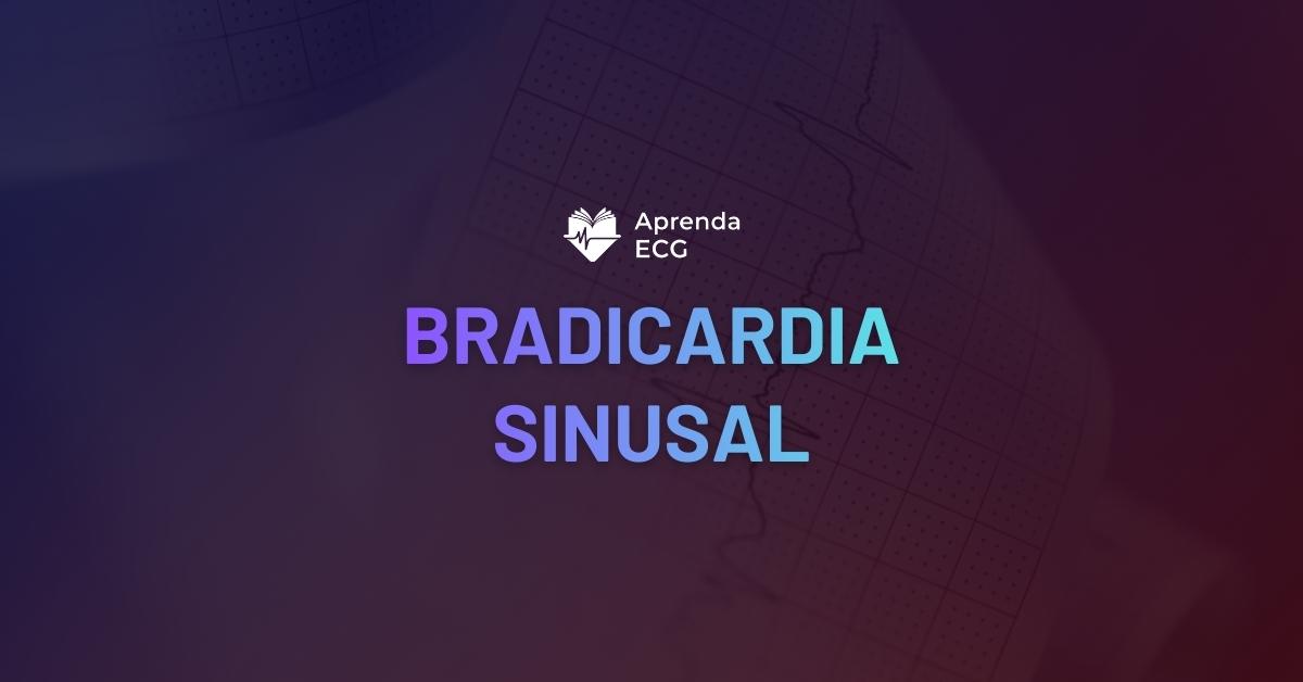 Bradicardia Sinusal