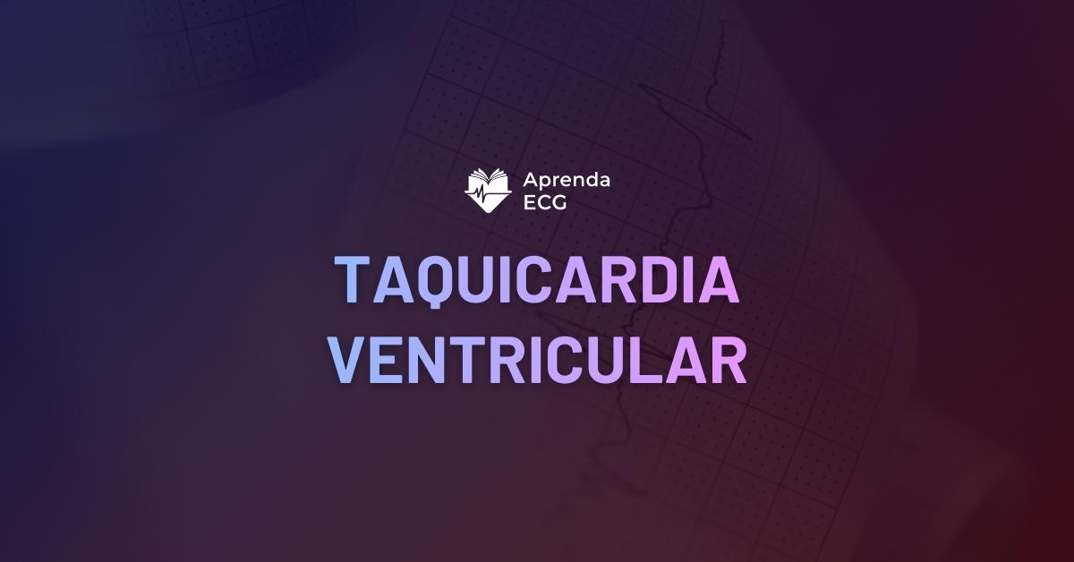 Taquicardia Ventricular