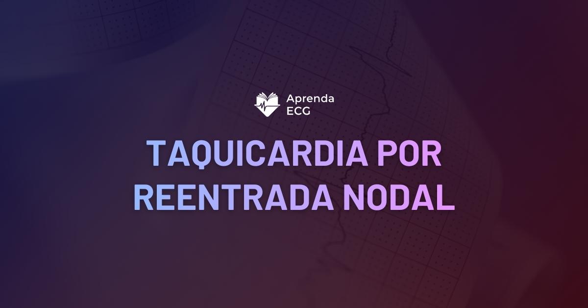 Taquicardia por Reentrada Nodal