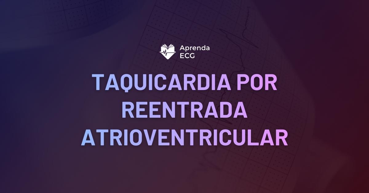 Taquicardia por Reentrada Atrioventricular