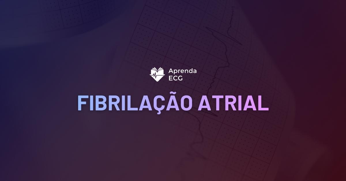 Fibrilação Atrial
