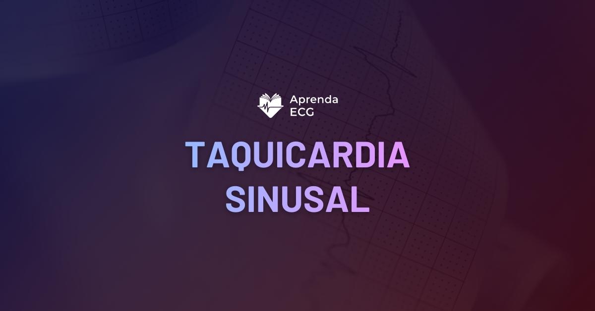 Taquicardia Sinusal