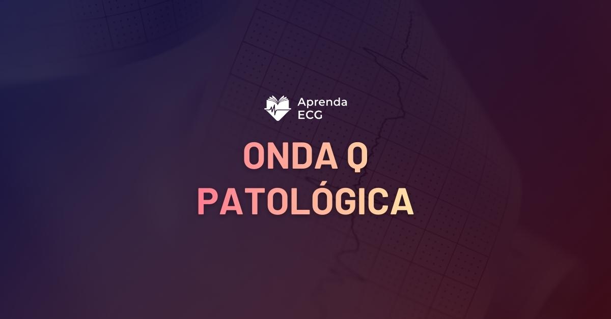 Áreas Eletricamente Inativas (Ondas Q patológicas)