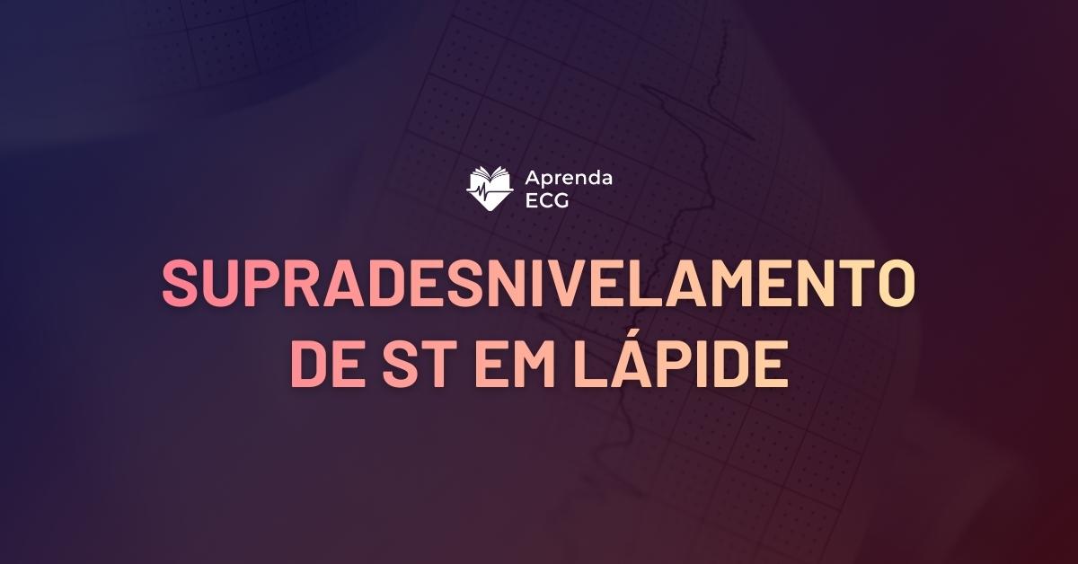 Padrão de Supradesnivelamento de ST em Lápide (Tombstone)