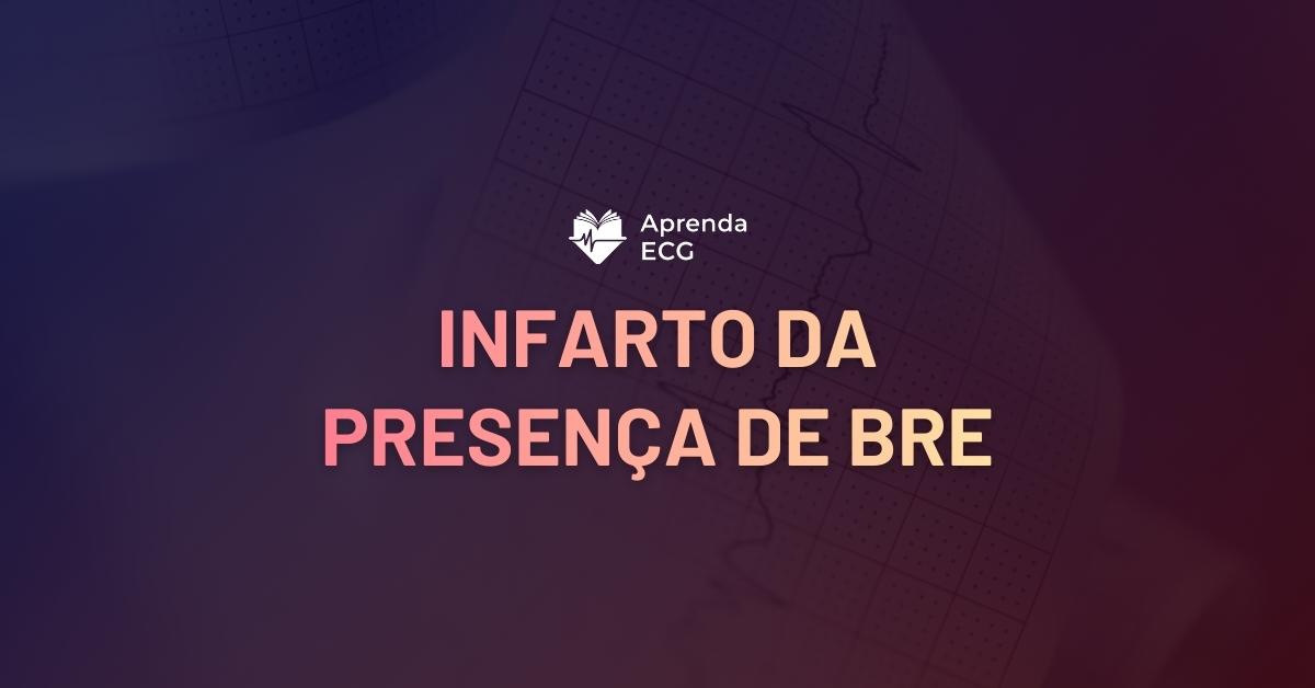 IAM na presença de BRE