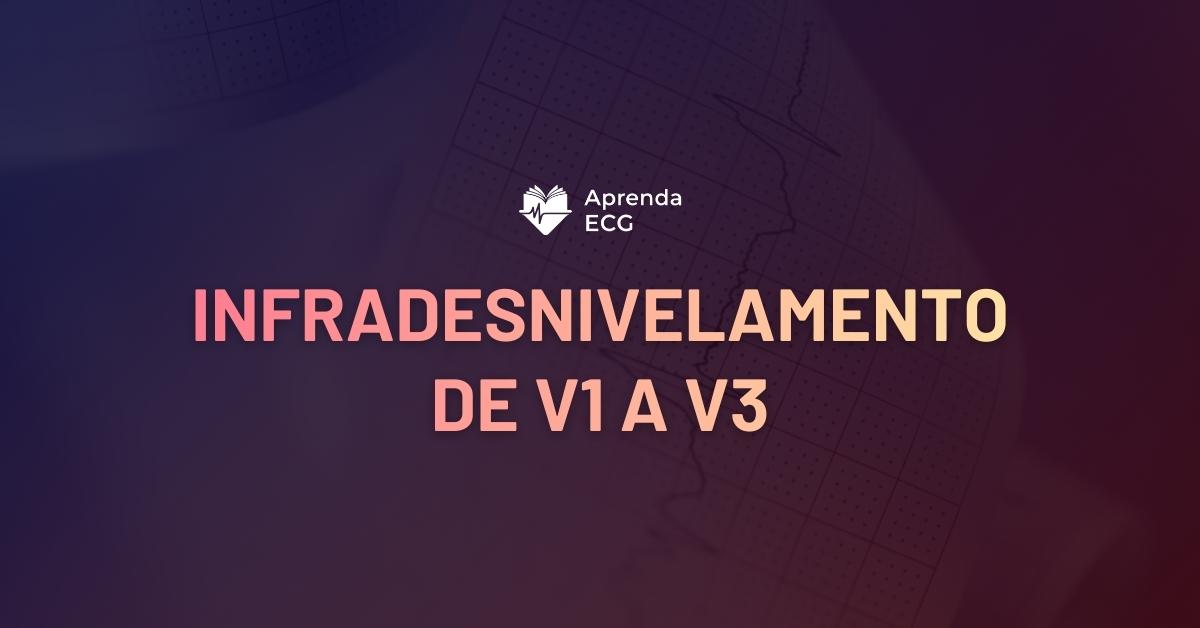 Infradesnivelamento de V1 a V3