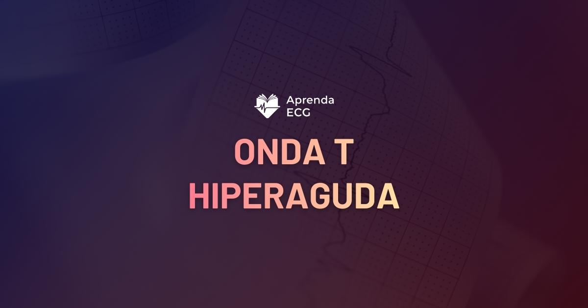 Onda T hiperaguda