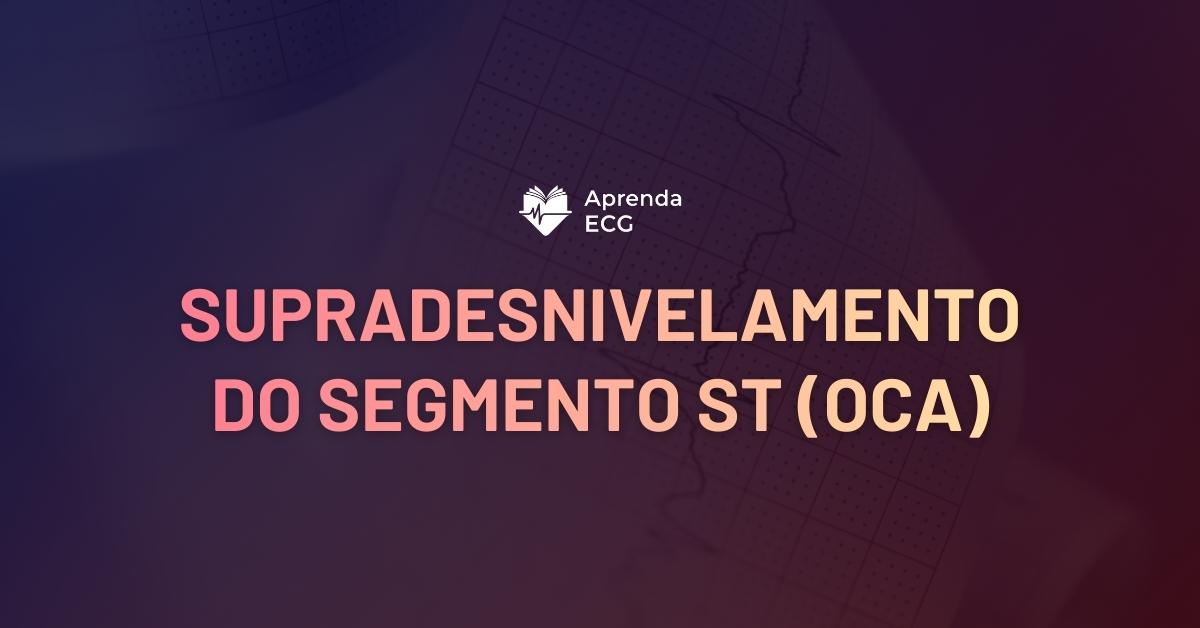 Supradesnivelamento do Segmento ST (OCA)