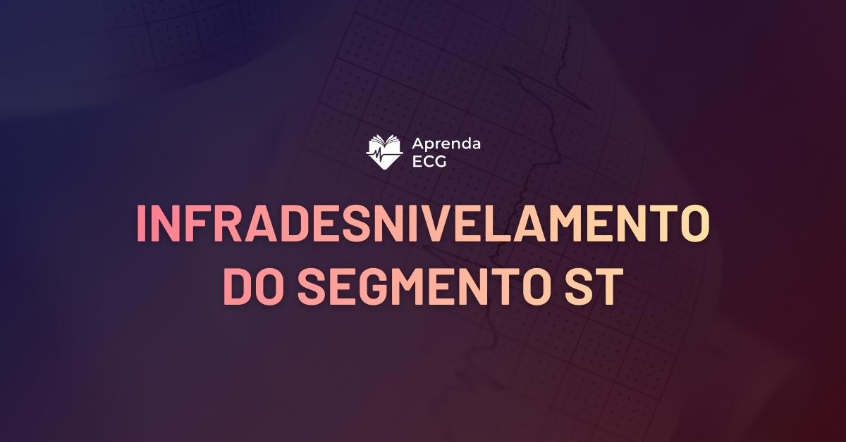 Infradesnivelamento do Segmento ST