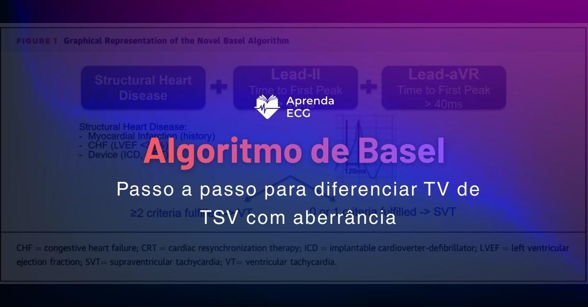 Algoritmo de Basel: passo a passo para diferenciar TV de TSV com aberrância