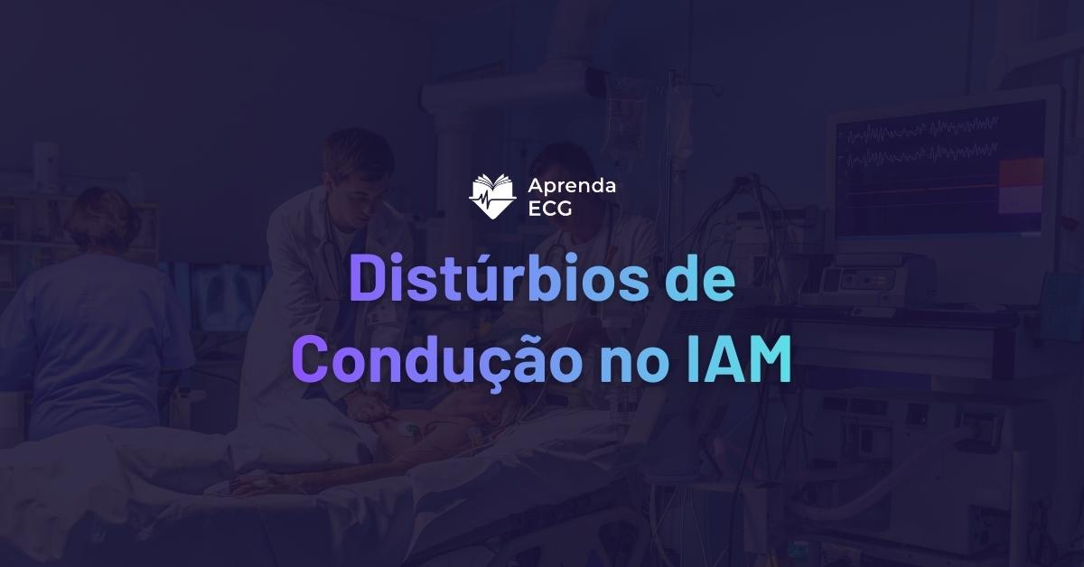 Distúrbios de Condução no Infarto Agudo do Miocárdio