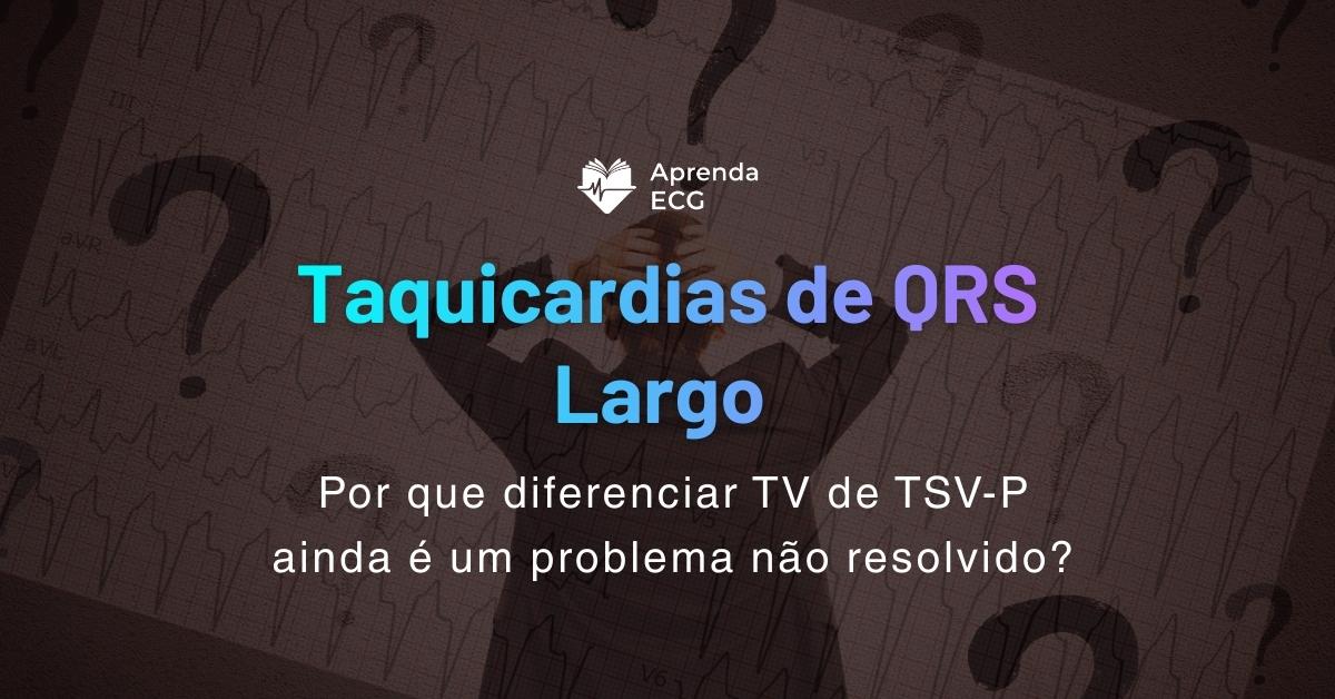 Taquicardias de QRS Largo: por que diferenciar TV de TSV-P ainda é um problema não resolvido?
