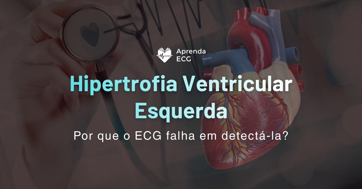 Por que o ECG falha em detectar hipertrofia ventricular esquerda?