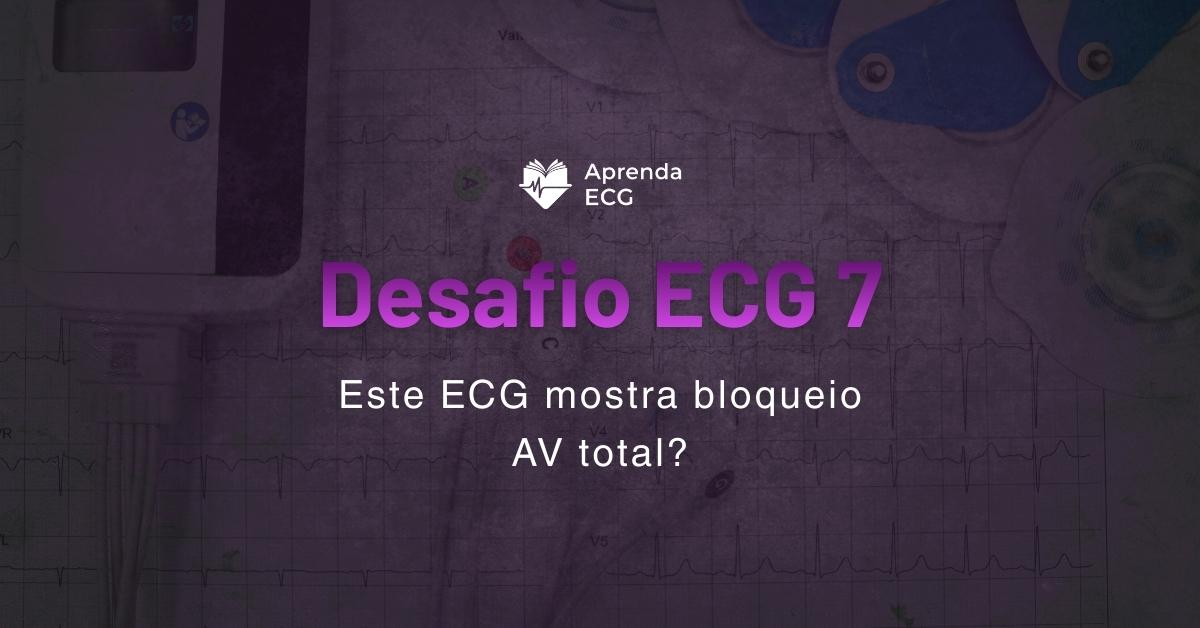 Desafio ECG 7: Este ECG mostra bloqueio AV total?