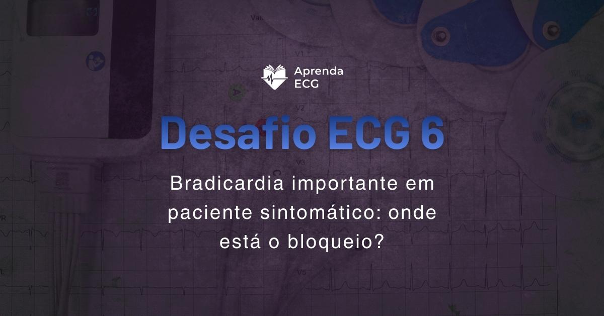 Desafio ECG 6: Bradicardia importante em paciente sintomático: onde está o bloqueio?