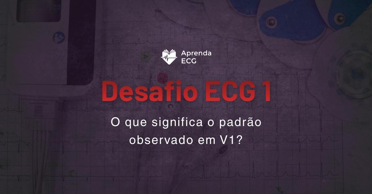 Desafio ECG 1: Padrão qR em V1: o que explica?