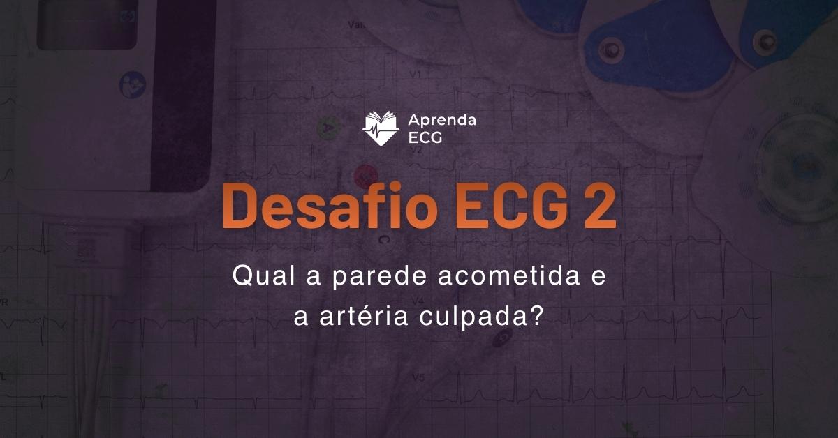 Desafio ECG 2: Qual a parede acometida e a artéria culpada?