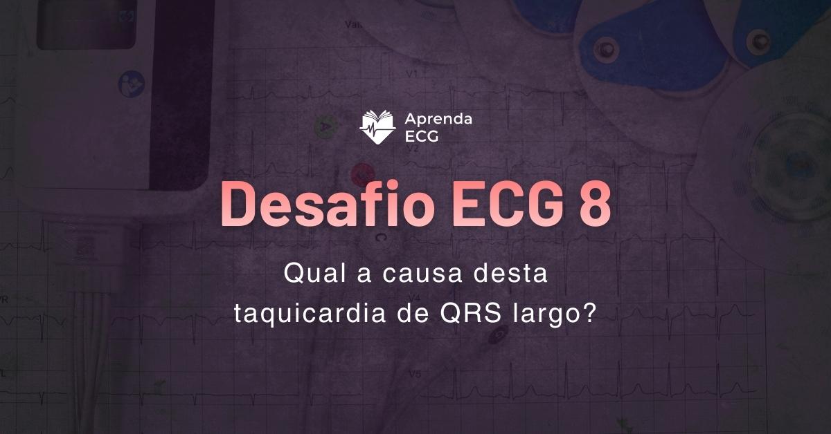 Desafio ECG 8: Qual a causa desta taquicardia de QRS largo?