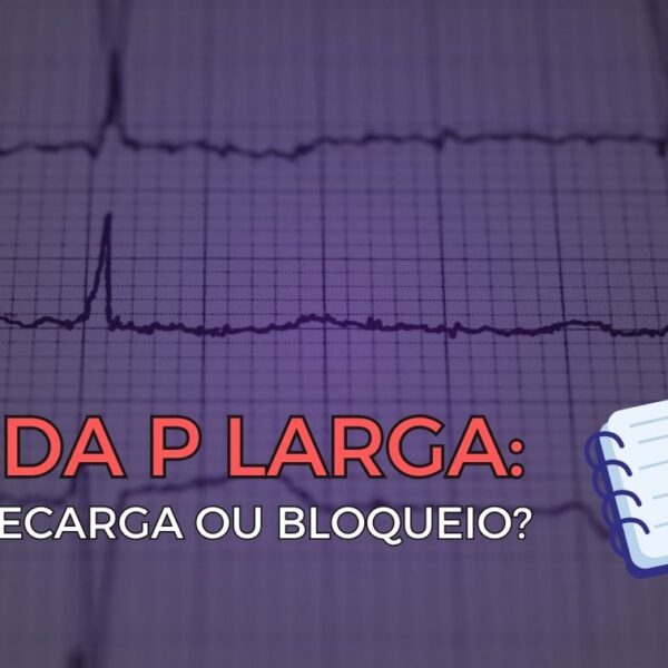 Eletrocardiograma com qt longo