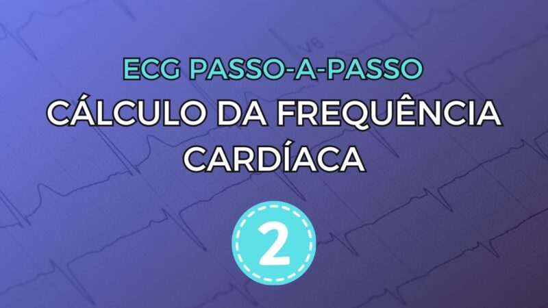 Algoritmo de Vereckei para o diagnóstico diferencial entre taquicardia ventricular e taquicardia supraventricular com aberrância no eletrocardiograma