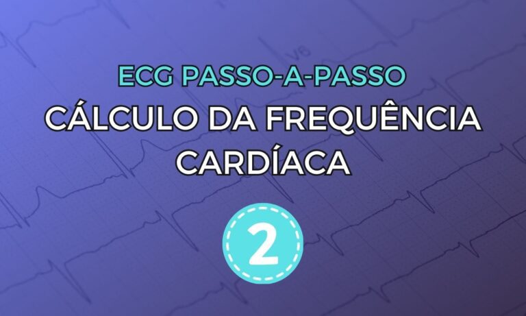 Eletrocardiograma com progressão lenta da onda R
