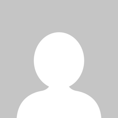 Eletrocardiograma com extrassístoles ventriculares (bigeminismo ventricular)