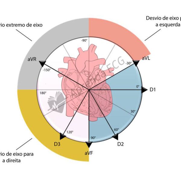 Eletrocardiograma de fibrilação atrial