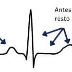 Livro ECG Passo a Passo