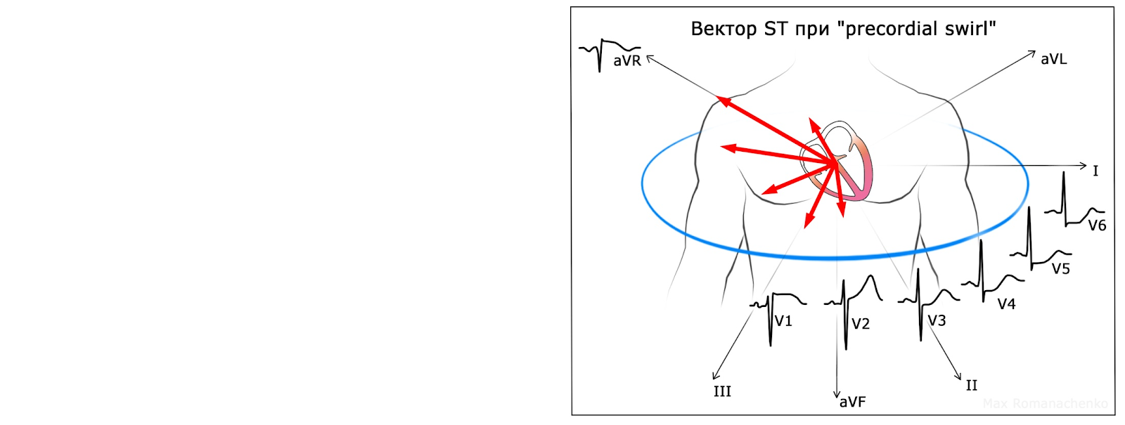 Derivações eletrocardiográfica V7, V8 e V9