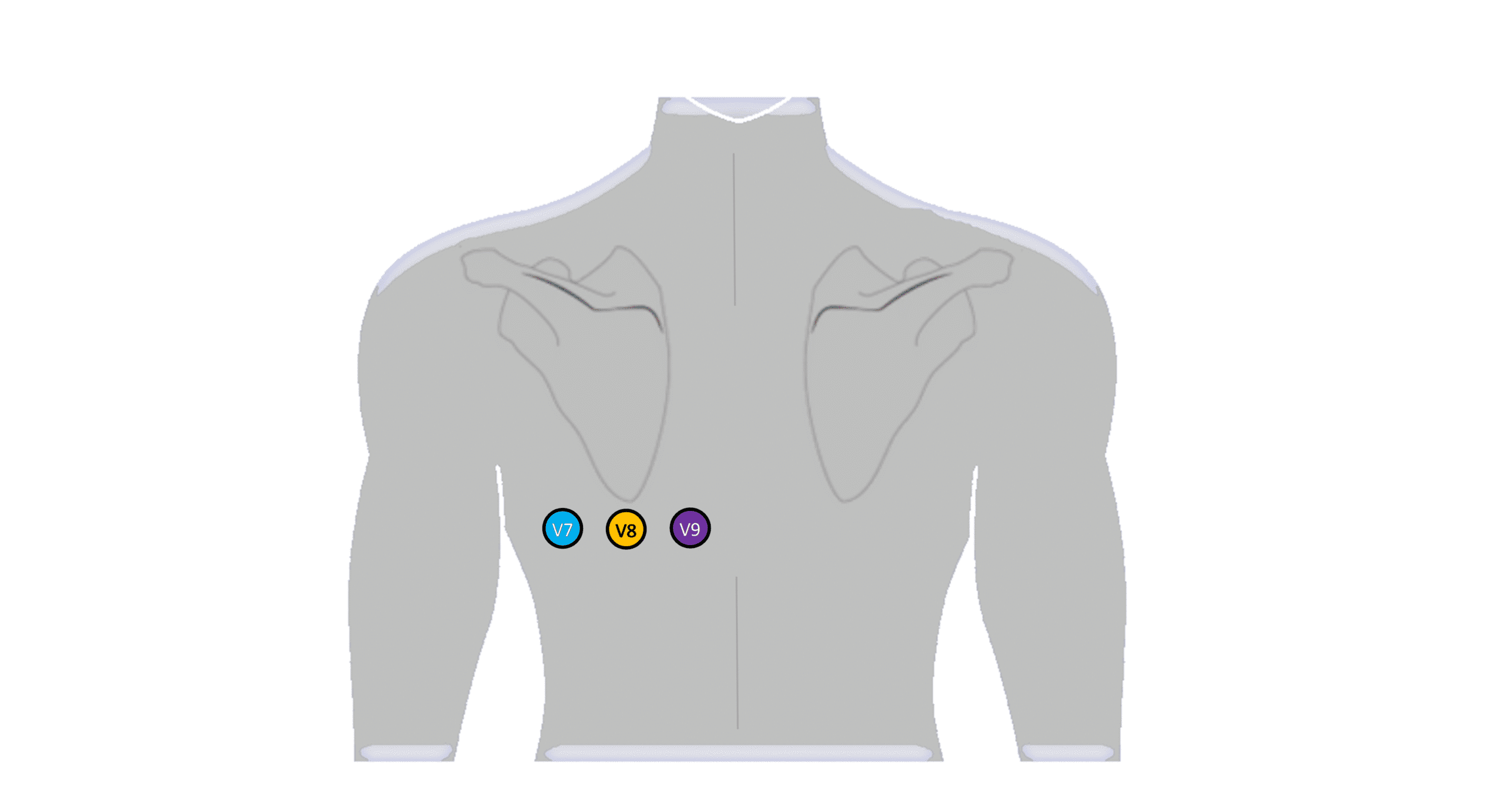Eixo elétrico no ECG