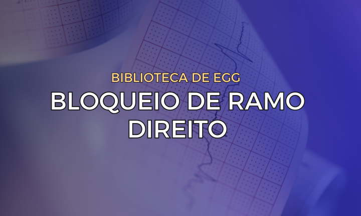 Leia mais sobre o artigo Bloqueio de Ramo Direito