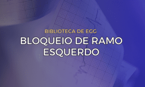 Leia mais sobre o artigo Bloqueio de Ramo Esquerdo