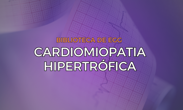 Leia mais sobre o artigo Cardiomiopatia Hipertrófica