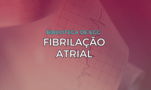 Leia mais sobre o artigo Fibrilação Atrial