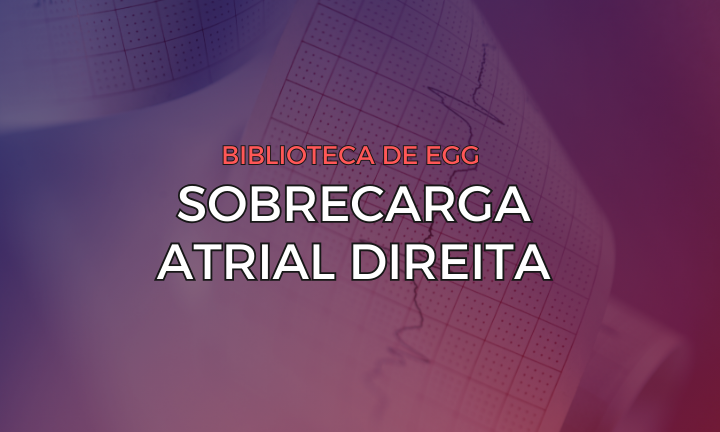 Leia mais sobre o artigo Sobrecarga Atrial Direita