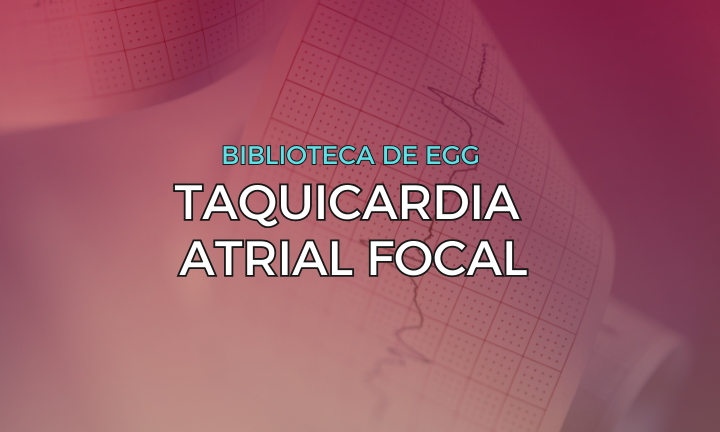 Leia mais sobre o artigo Taquicardia Atrial Focal