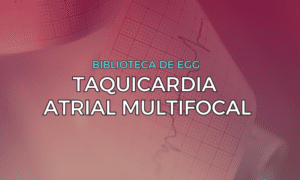 Leia mais sobre o artigo Taquicardia Atrial Multifocal