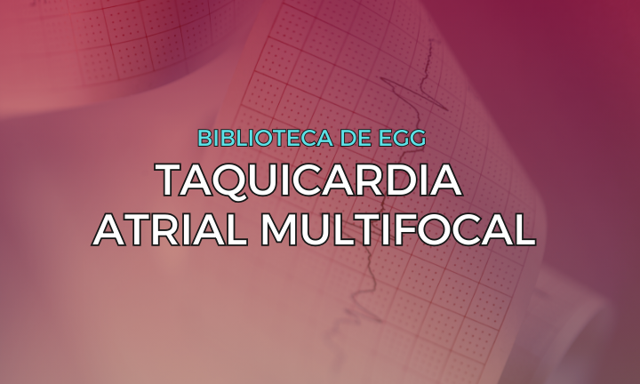 Leia mais sobre o artigo Taquicardia Atrial Multifocal