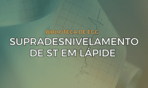 Leia mais sobre o artigo Padrão de Supradesnivelamento de ST em Lápide (Tombstone)