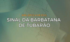 Leia mais sobre o artigo Sinal da Barbatana de Tubarão