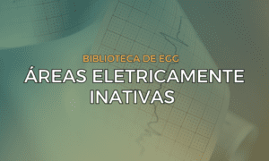 Leia mais sobre o artigo Áreas Eletricamente Inativas (Ondas Q patológicas)