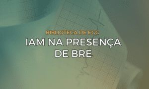 Leia mais sobre o artigo IAM na presença de BRE