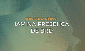 Leia mais sobre o artigo IAM na presença de BRD